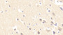 DAB staining on IHC-P; Samples: Human Cerebrum Tissue; Primary Ab: 20μg/ml Rabbit Anti-Human NPTX1 Antibody Second Ab: 2µg/mL HRP-Linked Caprine Anti-Rabbit IgG Polyclonal Antibody