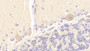 DABstainingonIHC-P.Samples:HumanTissue)