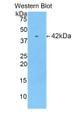 Western Blot; Sample: Recombinant protein.