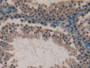 DAB staining on fromalin fixed paraffin- embedded kidney tissue)