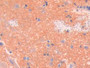 DAB staining on IHC-P; Samples: Rat Spinal cord Tissue; Primary Ab: 20µg/ml Rabbit Anti-Rat SPTAN1 Antibody Second Ab: 2µg/mL HRP-Linked Caprine Anti-Rabbit IgG Polyclonal Antibody