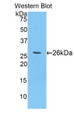 Western Blot; Sample: Recombinant protein.