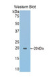 Western Blot; Sample: Recombinant protein.