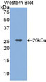 Western Blot; Sample: Recombinant protein.