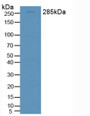 Western Blot; Sample: Rat Brain Tissue.