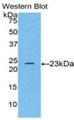 Western Blot; Sample: Recombinant protein.