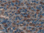 DAB staining on fromalin fixed paraffin- embedded stomach tissue)