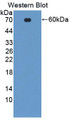 Western Blot; Sample: Recombinant protein.