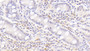 DAB staining on IHC-P; Samples: Human Small intestine Tissue;  Primary Ab: 20μg/ml Rabbit Anti-Human BAFFR Antibody Second Ab: 2µg/mL HRP-Linked Caprine Anti-Rabbit IgG Polyclonal Antibody 