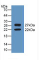 Western Blot; Sample: Recombinant CNX, Mouse.