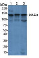 Western Blot; Sample: Lane1: Human Jurkat Cells; Lane2: Human K562 Cells; Lane3: Human Raji Cells.