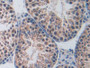 DAB staining on IHC-P; Samples: Mouse Testis Tissue; Primary Ab: 10µg/ml Rabbit Anti-Mouse PARP Antibody Second Ab: 2µg/mL HRP-Linked Caprine Anti-Rabbit IgG Polyclonal Antibody