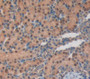 Poly Adp Ribose Polymerase (Parp) Polyclonal Antibody, Cat#CAU28202