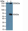 Western Blot; Sample: Lane1: Rat Serum; Lane2: Human HepG2 Cells.