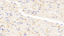 DAB staining on IHC-P; Samples: Rat Cardiac Muscle Tissue;  Primary Ab: 10μg/ml Rabbit Anti-Rat CX43 Antibody Second Ab: 2µg/mL HRP-Linked Caprine Anti-Rabbit IgG Polyclonal Antibody 
