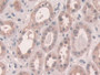 DAB staining on IHC-P; Samples: Human Kidney Tissue; Primary Ab: 10µg/ml Rabbit Anti-Human CX43 Antibody Second Ab: 2µg/mL HRP-Linked Caprine Anti-Rabbit IgG Polyclonal Antibody