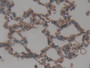 DAB staining on IHC-P; Samples: Rat Lung Tissue;  Primary Ab: 10µg/ml Rabbit Anti-Rat ITGaD Antibody