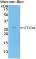 Western Blot; Sample: Recombinant PLCg1, Human.