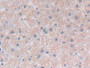 DAB staining on IHC-P; Samples: Human Liver Tissue; Primary Ab: 30µg/ml Rabbit Anti-Human PLCg1 Antibody Second Ab: 2µg/mL HRP-Linked Caprine Anti-Rabbit IgG Polyclonal Antibody