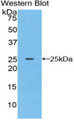 Western Blot; Sample: Recombinant protein.