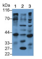 Western Blot; Sample: Lane1: Mouse Cartilage lysate; Lane2: Mouse Placenta lysate; Lane3: Mouse Lung lysate; Primary Ab: 1.5μg/ml Rabbit Anti-Mouse CTSK Antibody; Second Ab: 0.2µg/mL HRP-Linked Caprine Anti-Rabbit IgG Polyclonal Antibody;