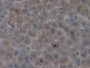 DAB staining on IHC-P; Samples: Mouse Liver Tissue