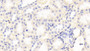 DAB staining on IHC-P; Samples: Rat Kidney Tissue; Primary Ab: 20μg/ml Rabbit Anti-Rat b2M Antibody Second Ab: 2µg/mL HRP-Linked Caprine Anti-Rabbit IgG Polyclonal Antibody