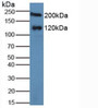 Western Blot; Sample: Human Serum.