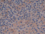 DAB staining on IHC-P; Samples: Rat Adrenal gland Tissue; Primary Ab: 30µg/ml Rabbit Anti-Rat APOC1 Antibody Second Ab: 2µg/mL HRP-Linked Caprine Anti-Rabbit IgG Polyclonal Antibody