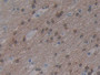 DAB staining on fromalin fixed paraffin- embedded brain tissue)