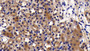 DAB staining on IHC-P; Samples: Mouse Kidney Tissue;  Primary Ab: 20μg/ml Rabbit Anti-Mouse CASP2 Antibody Second Ab: 2µg/mL HRP-Linked Caprine Anti-Rabbit IgG Polyclonal Antibody 