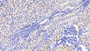DAB staining on IHC-P; Samples: Human Kidney Tissue; Primary Ab: 20μg/ml Rabbit Anti-Human CASP2 Antibody Second Ab: 2µg/mL HRP-Linked Caprine Anti-Rabbit IgG Polyclonal Antibody