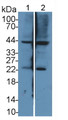 Western Blot; Sample: Lane1: Mouse Cerebrum lysate; Lane2: Mouse Heart lysate;; Primary Ab: 1µg/mL Rabbit Anti-Mouse NES1 Antibody; Second Ab: 0.2µg/mL HRP-Linked Caprine Anti-Rabbit IgG Polyclonal Antibody;