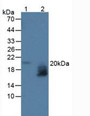 Western Blot; Sample: Lane1: Human Serum; Lane2: Human Urine.