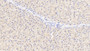 DAB staining on IHC-P; Samples: Porcine Liver Tissue;  Primary Ab: 20µg/ml Rabbit Anti-Porcine TYR Antibody Second Ab: 2µg/mL HRP-Linked Caprine Anti-Rabbit IgG Polyclonal Antibody 