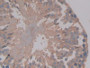 DAB staining on IHC-P; Samples: Rat Testis Tissue; Primary Ab: 20µg/ml Rabbit Anti-Rat AMH Antibody Second Ab: 2µg/mL HRP-Linked Caprine Anti-Rabbit IgG Polyclonal Antibody