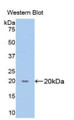 Western Blot; Sample: Recombinant protein.