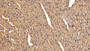 DAB staining on IHC-P; Samples: Rat Heart Tissue;  Primary Ab: 20µg/ml Rabbit Anti-Rat NT-ProANP Ant