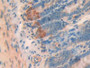 DAB staining on IHC-P; Samples: Rat Small intestine Tissue; Primary Ab: 20µg/ml Rabbit Anti-Rat NT-ProANP Antibody Second Ab: 2µg/mL HRP-Linked Caprine Anti-Rabbit IgG Polyclonal Antibody