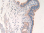 DAB staining on IHC-P; Samples: Mouse Uterus Tissue; Primary Ab: 30µg/ml Rabbit Anti-Mouse MMP11 Antibody Second Ab: 2µg/mL HRP-Linked Caprine Anti-Rabbit IgG Polyclonal Antibody