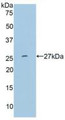 Western Blot; Sample: Recombinant MMP11, Human.