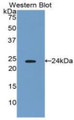 Western Blot; Sample: Recombinant protein.