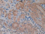 DAB staining on IHC-P; Samples: Mouse Kidney Tissue; Primary Ab: 10µg/ml Rabbit Anti-Mouse TCF20 Antibody Second Ab: 2µg/mL HRP-Linked Caprine Anti-Rabbit IgG Polyclonal Antibody