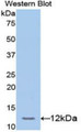 Western Blot; Sample: Recombinant protein.