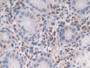 DAB staining on IHC-P; Samples: Human Stomach Tissue; Primary Ab: 30µg/ml Rabbit Anti-Human TGFb2 Antibody Second Ab: 2µg/mL HRP-Linked Caprine Anti-Rabbit IgG Polyclonal Antibody