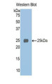 Western Blot; Sample: Recombinant protein.