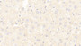 DAB staining on IHC-P; Samples: Mouse Liver Tissue; Primary Ab: 20μg/ml Rabbit Anti-Mouse a1M Antibody Second Ab: 2µg/mL HRP-Linked Caprine Anti-Rabbit IgG Polyclonal Antibody