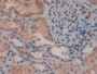 DAB staining on IHC-P; Samples: Human Kidney Tissue;  Primary Ab: 20µg/ml Rabbit Anti-Human a1M Anti