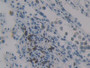 DAB staining on fromalin fixed paraffin- embedded stomach tissue)