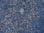 DAB staining on IHC-P; Samples: Mouse Spleen Tissue;  Primary Ab: 20µg/ml Rabbit Anti-Mouse COL1a2 A